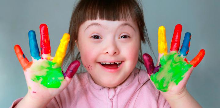 sindrome-down
