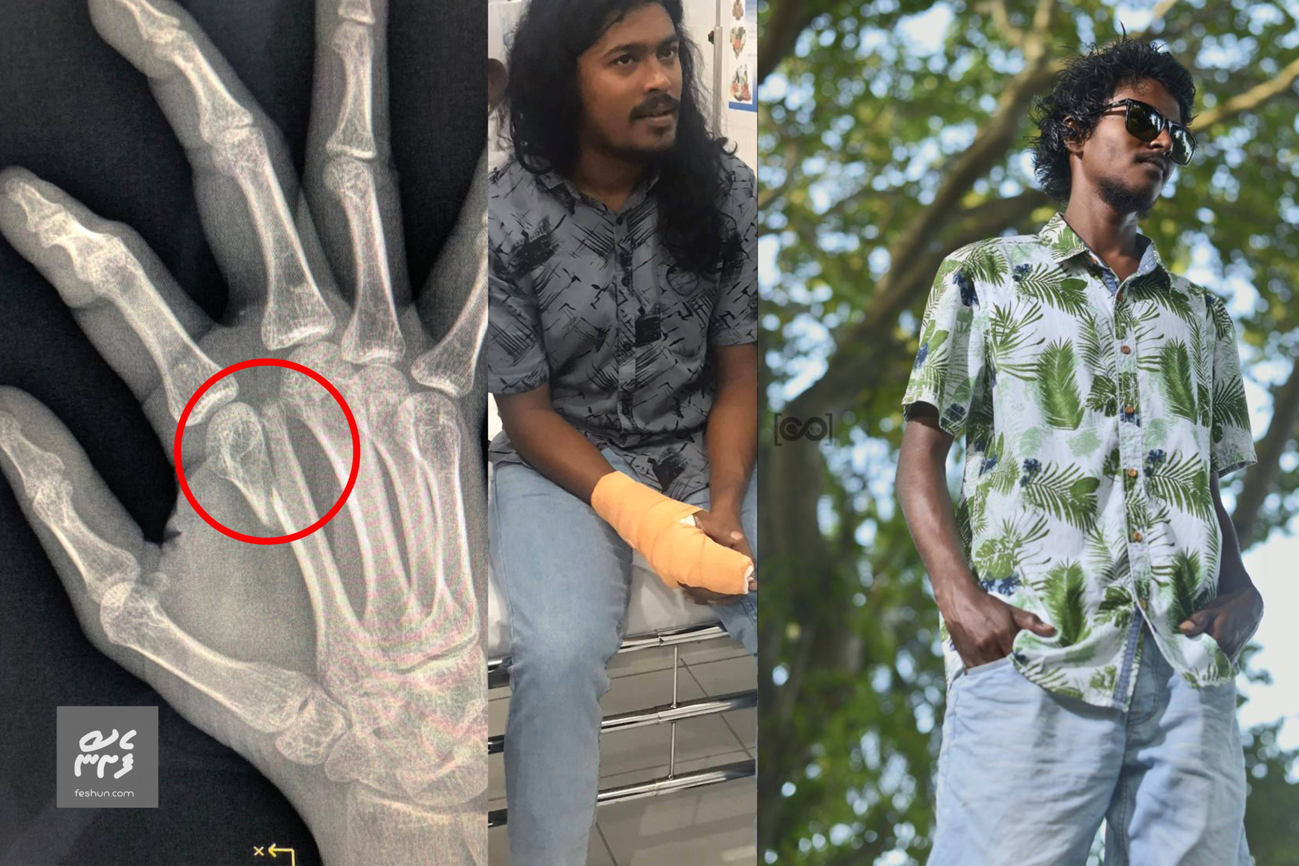 އަނިޔާވި ދެ ޒުވާނުން ، މި ޒުވާނުންނަށް އަނިޔާކޮށްފައިވަނީ ޕޮލިސް ސްޓޭޝަނުގައި - ފޮޓޯ: މީސްމީޑީއާ