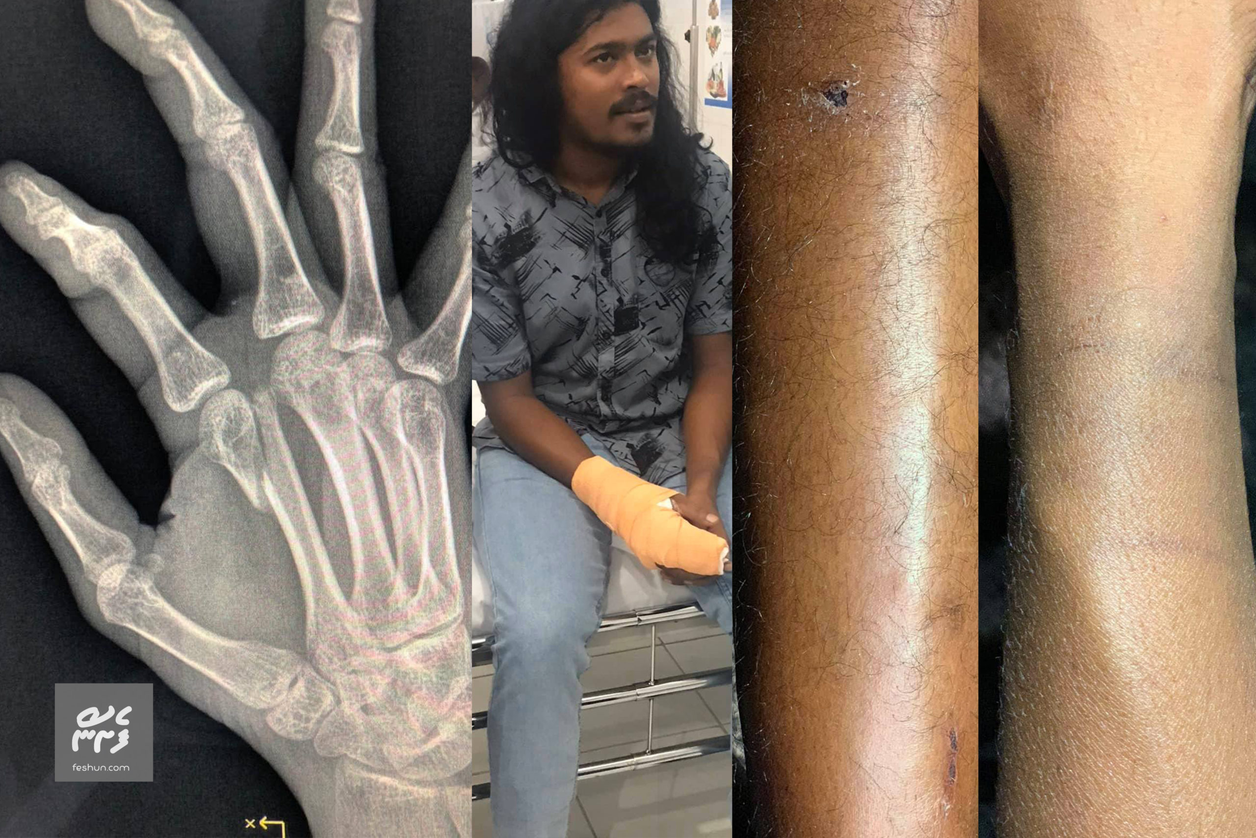 ކުޅުދުއްފުށީ ޕޮލިސް ސްޓޭޝަނުގައި އަނިޔާކޮށްފައި